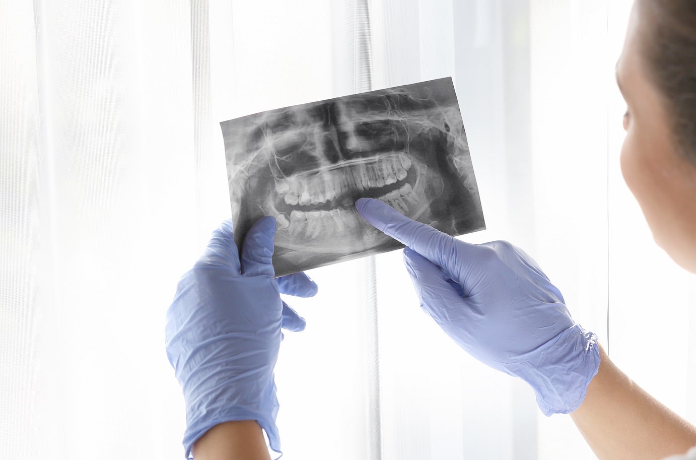 3 Times When Surgical Tooth Extraction Is Necessary Santa Rosa Oral Surgery