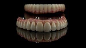 dental implants on a black background