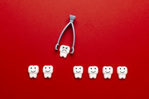 santa rosa wisdom tooth extraction