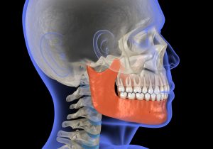 santa rosa jaw surgery