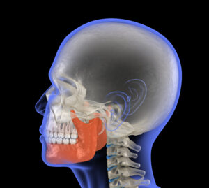 santa rosa jaw surgery