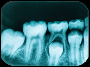 santa rosa oral pathology