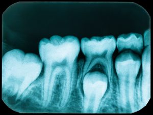 santa rosa oral pathology