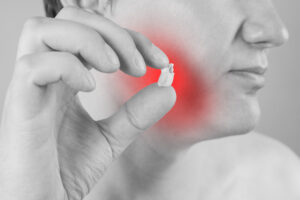 santa rosa wisdom tooth extraction