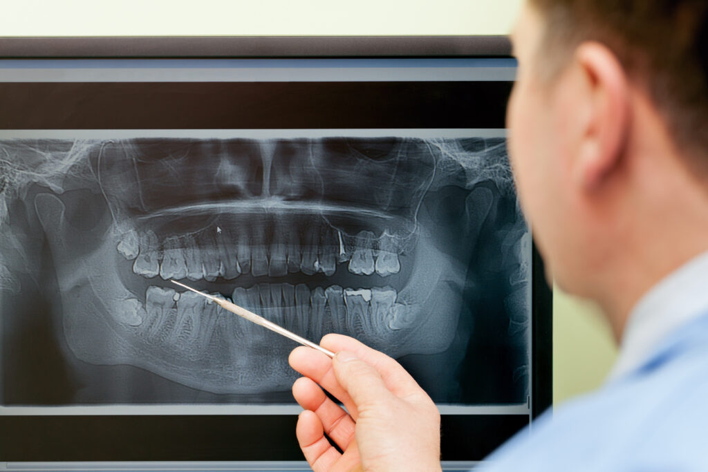 santa rosa facial trauma