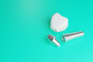 santa rosa dental implants