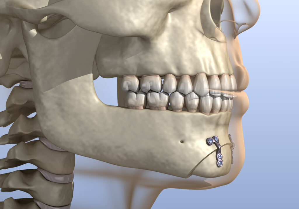 santa rosa facial trauma