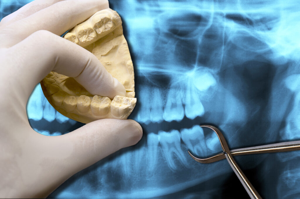 santa rosa oral sedation