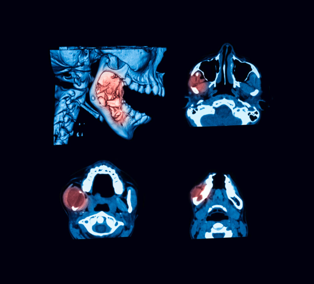 santa rosa facial trauma