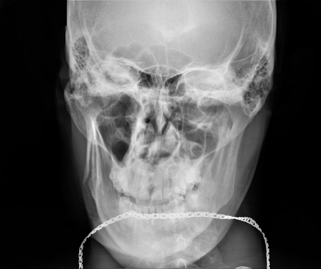 rohnert park facial trauma