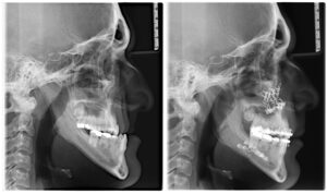 santa rosa jaw surgery