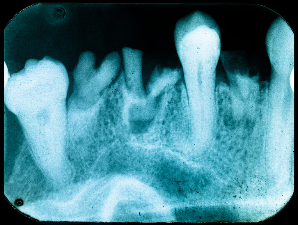 santa rosa oral pathology