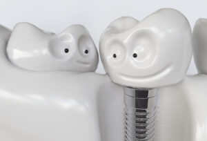 rohnert park dental implants
