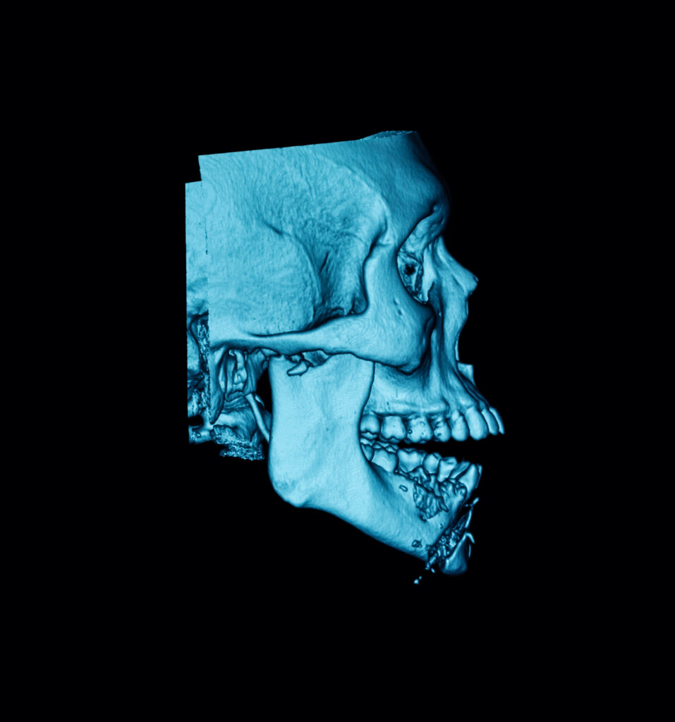 santa rosa facial trauma