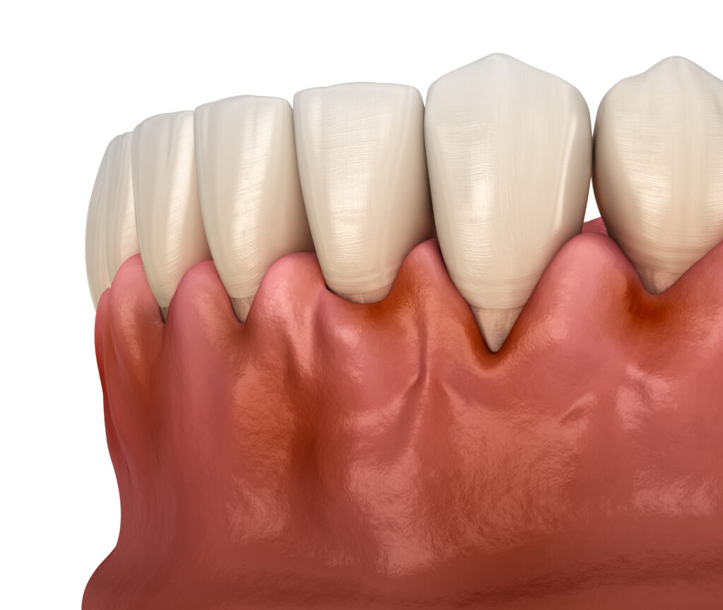 santa rosa oral pathology