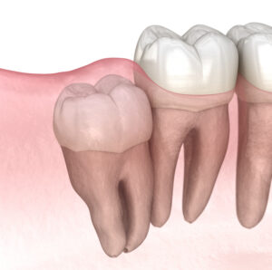 santa rosa oral surgeries