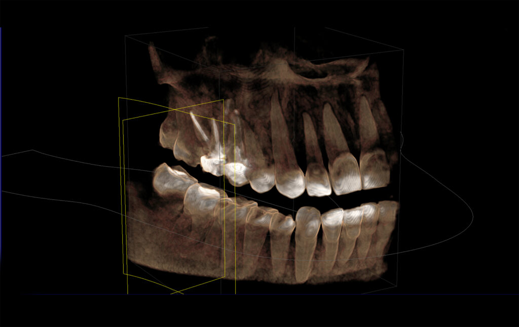 santa rosa facial trauma