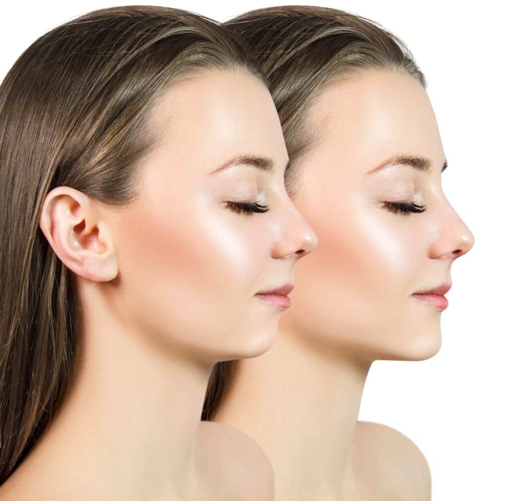 santa rosa jaw surgery