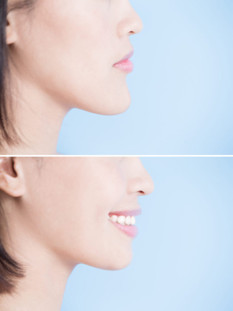 santa rosa jaw surgery