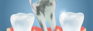 santa rosa tooth extraction